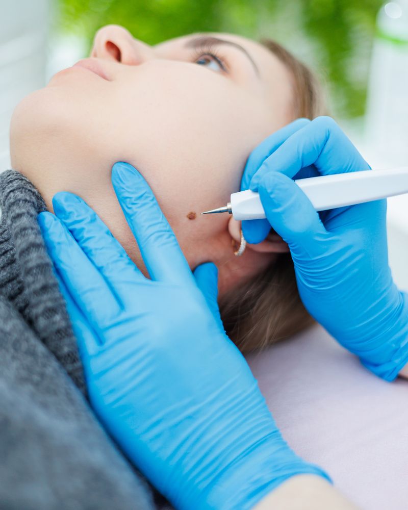 Electrocautery photo 02 1