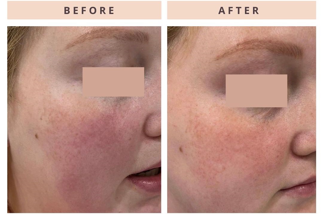 LEBAVascularDermClinPLLC01167759688764