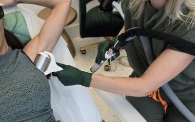 Is Laser Hair Removal really permanent?