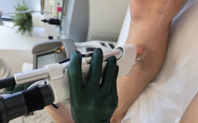 What happens if I miss a Laser Hair Removal Session?