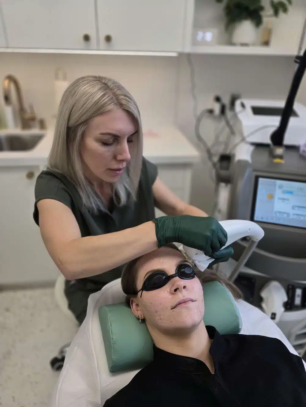 Acne scar treatment Calgary