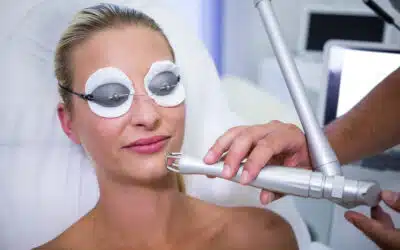 IPL Photofacial Benefits: Transform your skin in 2025