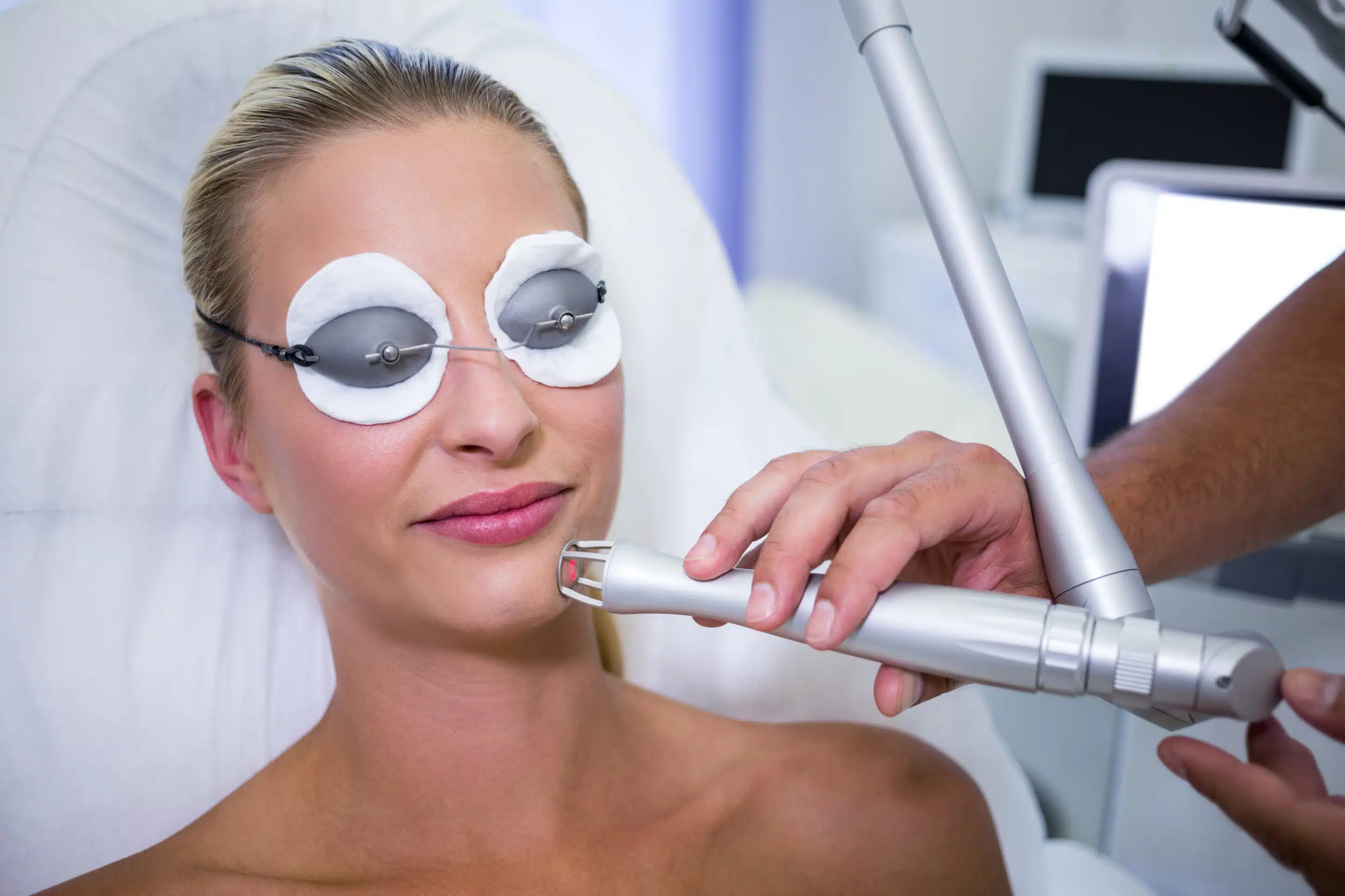 ipl photofacial benefits