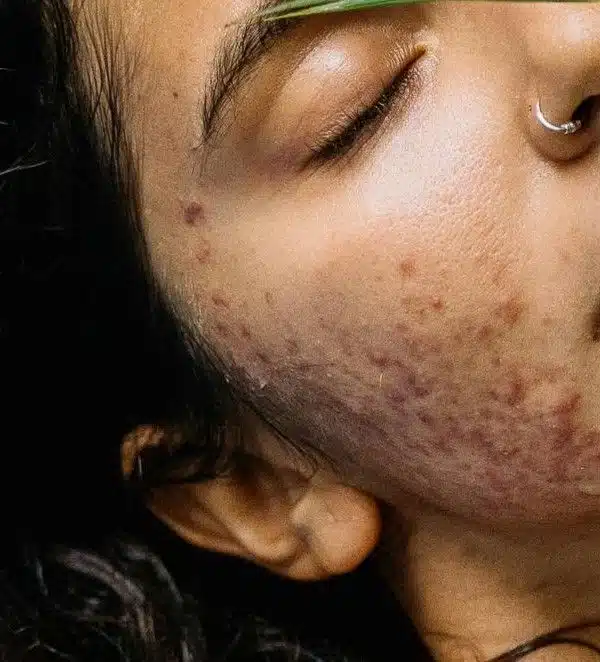 pexels anntarazevich 6268713 (1)