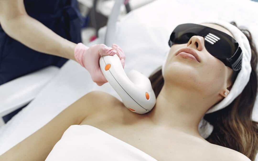 IPL Treatment for Rosacea