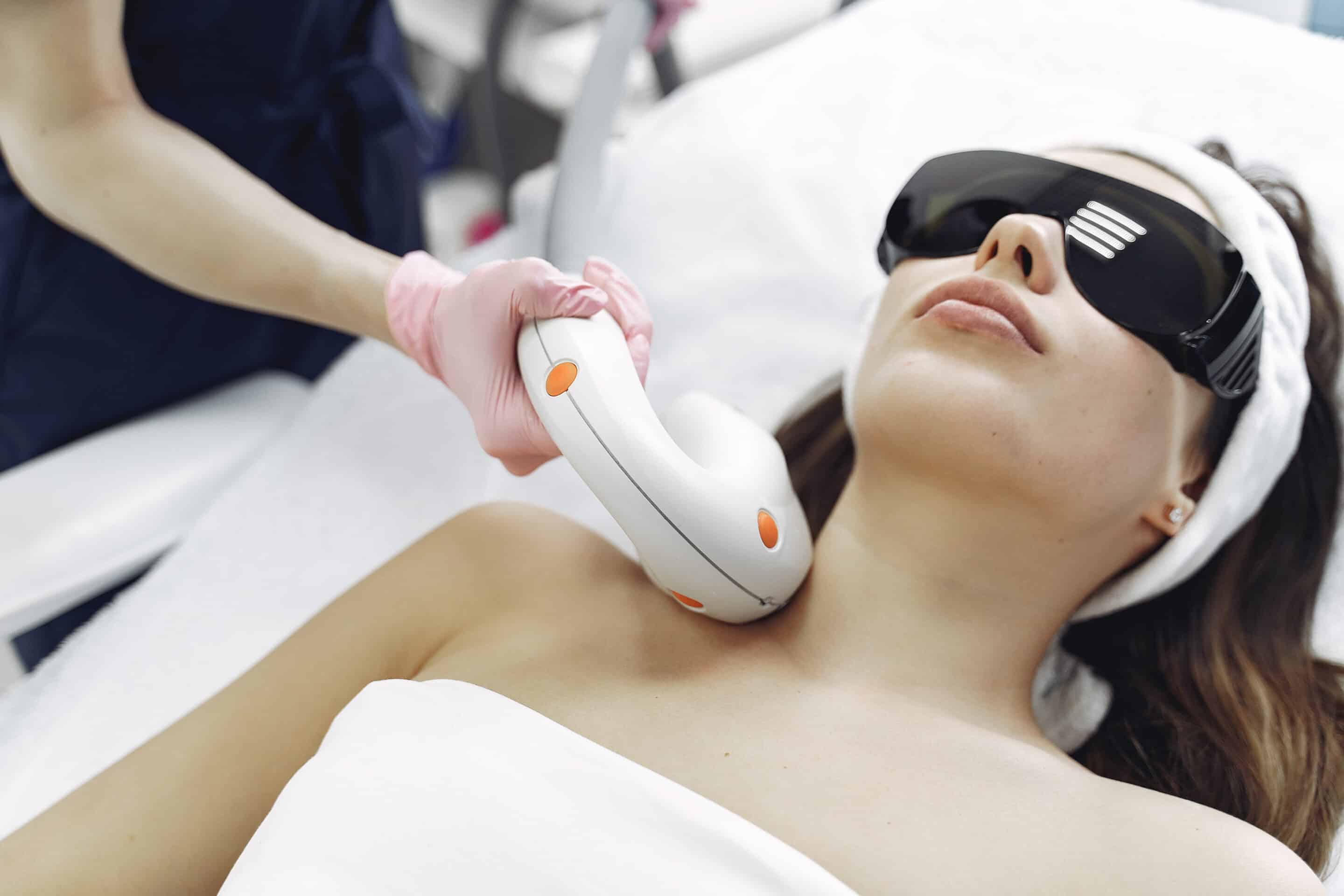 IPL Treatment for Rosacea
