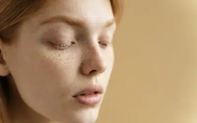 How to Remove Milia?