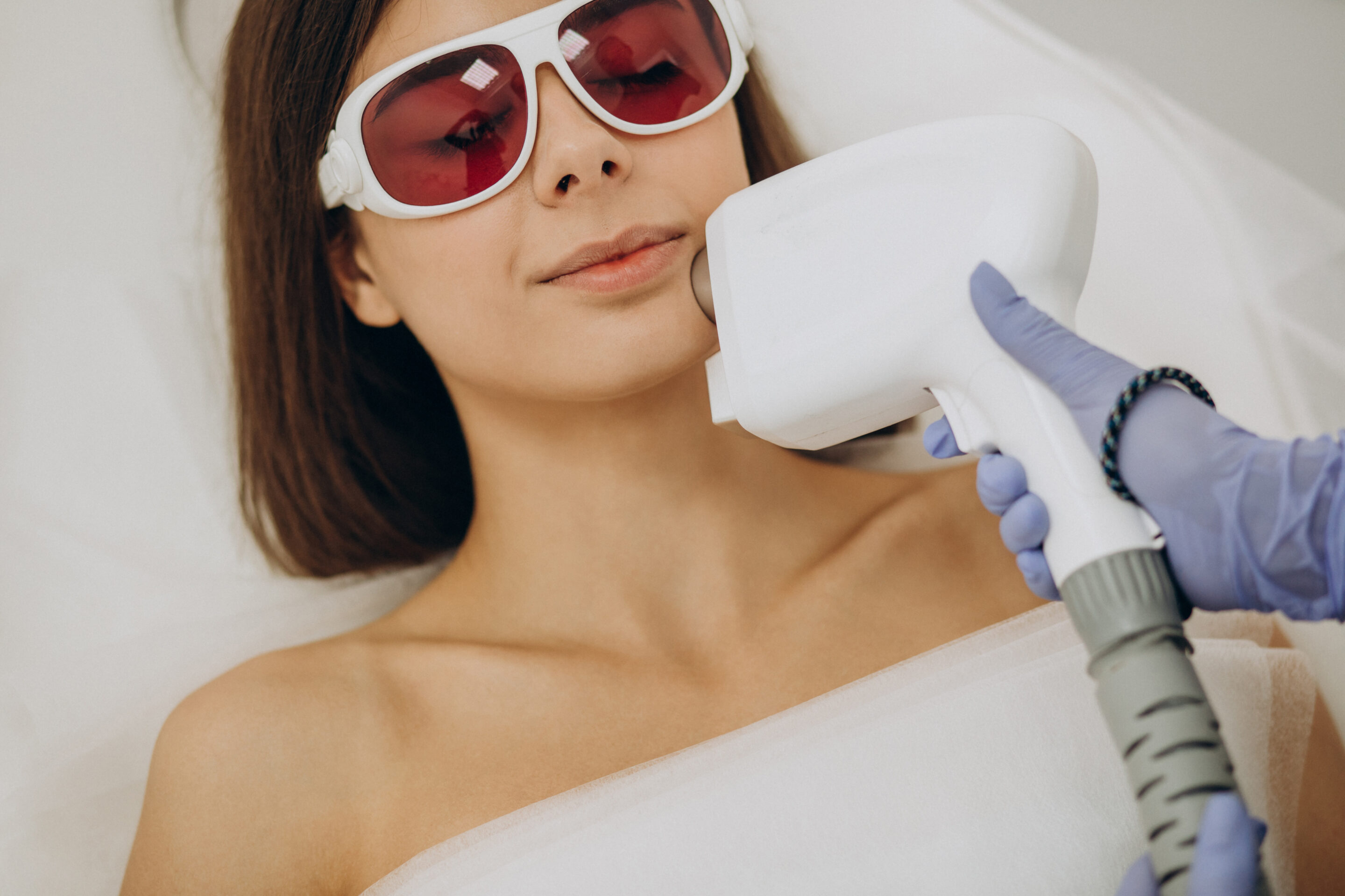 dos and don'ts after ipl treatment
