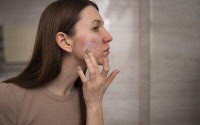 How to Remove Sun Damage on Face