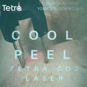 COOL PEEL