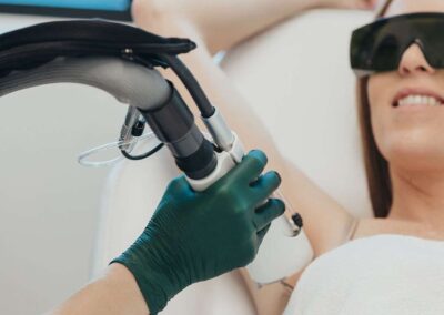 Laseer hair removal page 2 (1)