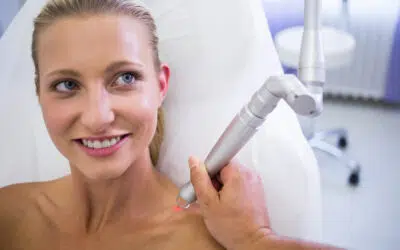 How many CO2 laser treatments are needed?