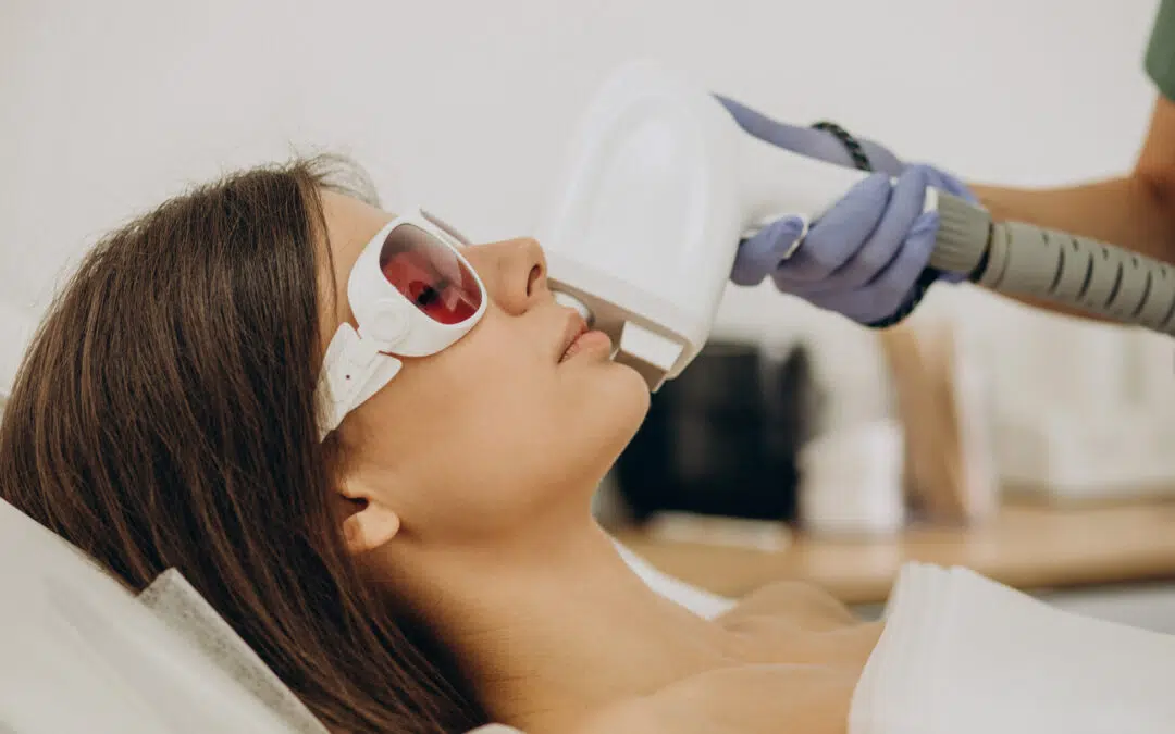 Laser Hair Removal on the Face: What to Expect