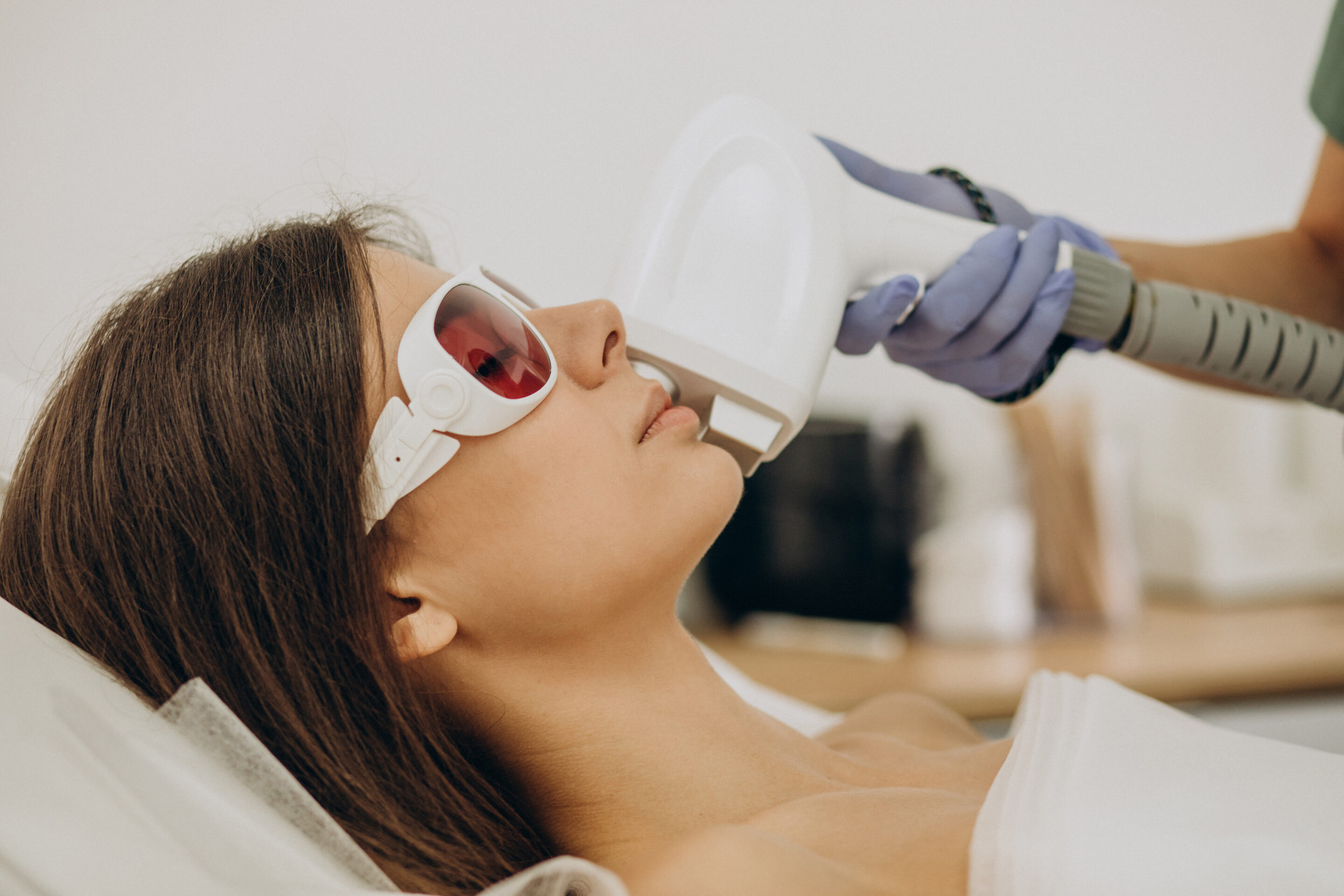 laser hair removal on the face