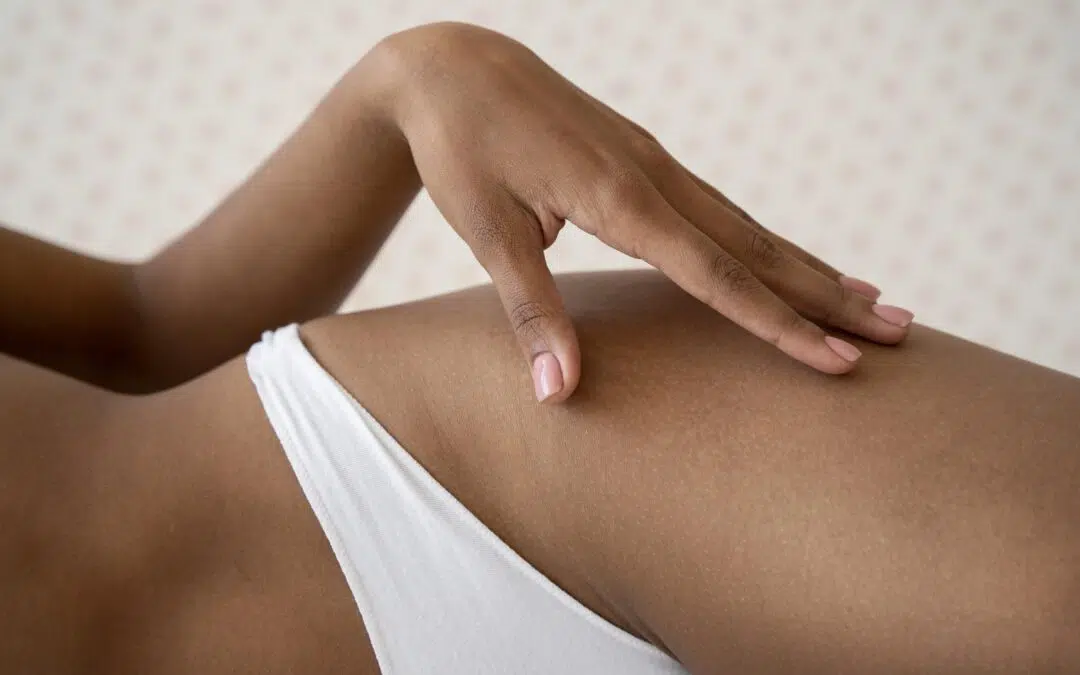 Brazilian Laser Hair Removal: Why Our Approach is Different