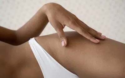 Brazilian Laser Hair Removal: Why Our Approach is Different