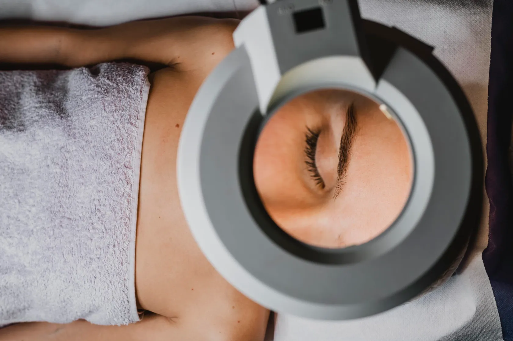 IPL Photo Facials Calgary 1 How Often Can You Do IPL?