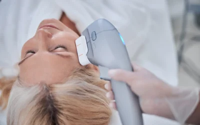 Laser Aesthetic Treatments in Calgary 1 How Much Does CO2 Laser Cost in Calgary in 2026?