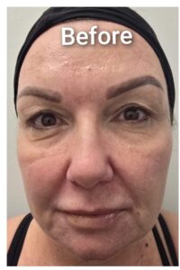 co2 recovery before co2 recovery before