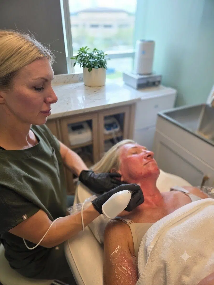 Laser Aesthetic Treatments in Calgary 1 Does microneedling hurt - practitioner performing microneedling in Calgary at Elysian Laser Aesthetics