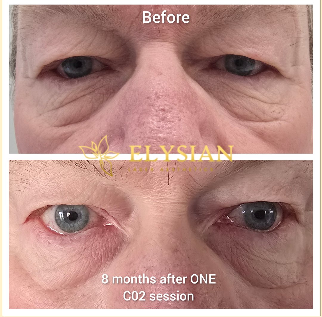 CO2 eyelid tightening Calgary - calming sage-green spa flat-lay at Elysian Laser Aesthetics